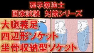 【四辺形ソケット＆坐骨収納型ソケット】大腿義足ソケットの種類と機能 ～No 116 理学療法士国家試験対策 シリーズ～ [upl. by Anotyal]