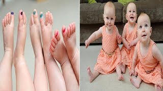 Identical Triplets Parents Have To Colour Code Their Toe Nails To Identify Them [upl. by Roana]