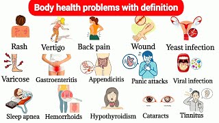 Body Health Problems  Illness Body Pain Vocabulary  Daily English Vocabulary  healthproblem [upl. by Logan]