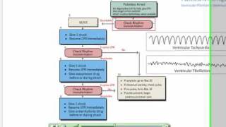 Pulseless Arrest Ventricular FibrillationVentricular Tachycardia Review [upl. by Liamaj57]