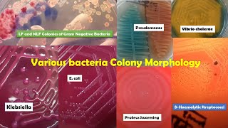 Various Bacteria Colonies Morphology Demo ProteusPseudomonasKlebsiellaPseudomonasStreptococcus [upl. by Pfeifer895]