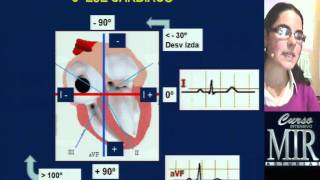 Cómo interpretar un ECG repaso [upl. by Anrehs24]