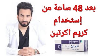 طريقة استخدام اكرتين لعلاج حب الشباب Acretin cream دكتور طلال المحيسن [upl. by Loella]