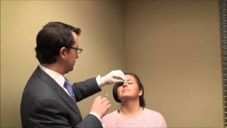 NonSurgical Nose Job  Dr Alex Donath [upl. by Bever757]