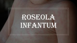 Pediatrics Infectious disease  Roseola infantum exanthem subitum [upl. by Artenek]