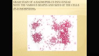 Gram negative bacteria Haemophilus influenzae [upl. by Dorr]