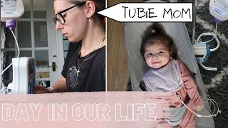 How to place an NG tube in a baby plus some helpful tips [upl. by Egreog]