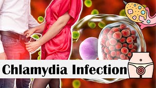 Chlamydia Infection  Causes Risk Factors Transmission Signs amp Symptoms Diagnosis amp Treatment [upl. by Aisek]