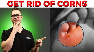 Calluses Foot Corns amp Plantar Wart Removal Top 10 Home Remedies [upl. by Myke12]