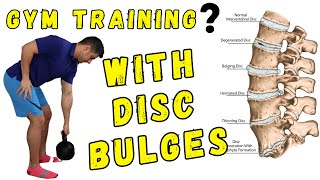 How to Train in the gym with lumbar disc bulges phase one [upl. by Ogden]