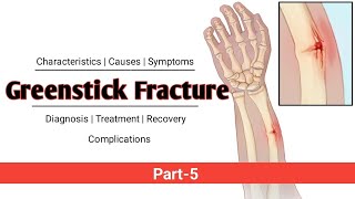 Greenstick Fracture  PART5  Explained in Hindi [upl. by Bor]