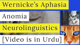 Wernickes Aphasia  Receptive Aphasia  Anomic Aphasia  Symptoms  Causes  Neurolinguistics [upl. by Ainigriv796]