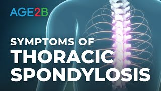 What Are the Symptoms of Thoracic Spondylosis Thoracic MidBack Pain or Disc Spondylolisthesis [upl. by Lap]