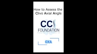 How to Assess the Clivo Axial Angle  CXA [upl. by Jacenta]