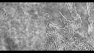 Pseudomonas aeruginosa Twitching Motility Type IV Pili in Action Supplemental Video 1 [upl. by Aurita]