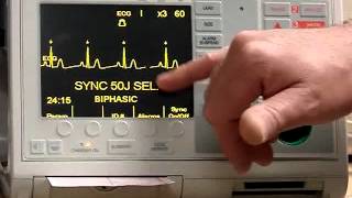 Zoll Defib PM Procedures [upl. by Milo]