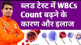 High Wbcs Count In Blood  ब्लड में WBCs बढ़ने के कारण और इलाज  High Wbc Count Treatment In Hindi [upl. by Anirat]