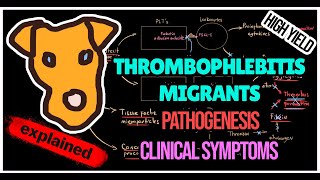 Thrombophlebitis migrants Trousseau syndrome Pathogenesis Symptoms Treatment [upl. by Lindon]