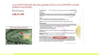 Introduction to glomerulonephritis part 2 Dr Ahmed Saeed Lecturer of internal Medicine nephrology [upl. by Rebm]