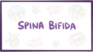 Spina bifida myelomeningocele meningocele occulta  causes symptoms treatment [upl. by Nittirb188]