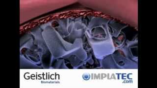 Guided Bone Regeneration with Geistlich Biomaterials [upl. by Suanne247]