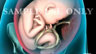 Breech Birth Position  3D Rotation [upl. by Ateuqahs]