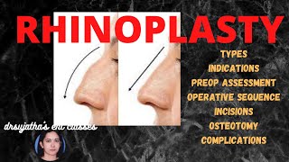 145Rhinoplasty Surgery  Part 12 nosejob surgeryeducation [upl. by Casper]