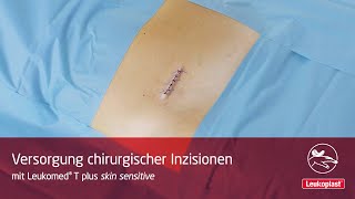 Leukoplast Leukomed T plus skin sensitive – Versorgung chirurgischer Inzisionen [upl. by Akiemat984]