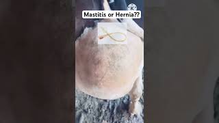 Mastitis Or Hernia  Rare case diagnosis karna sikhen  Dr Shanker Singh [upl. by Oiredised]