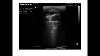 Cow estrous cycle show one follicular wave  bovine ultrasound السونار فى الابقار [upl. by Clarise131]