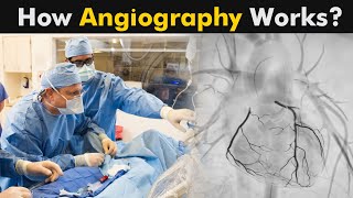 What is Angiography  How Coronary Angiography works UrduHindi [upl. by Lashonda]