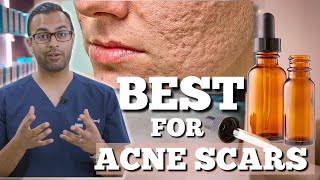 Best Ingredients For Acne Scars  How To Remove Acne Scars At Home  Dr Somjis Guide to Acne Scars [upl. by Gittle]