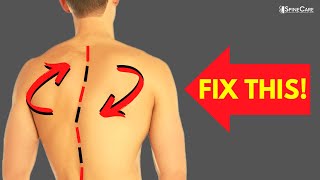 How to Fix a Twisted Back [upl. by Haraf]