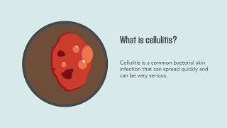 Cellulitis Causes Symptoms Diagnosis and Treatment  Merck Manual Consumer Version Quick Facts [upl. by Etnoel]