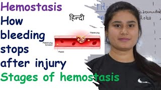 Hemostasis  Stages  Vasospasm  Clot Retraction amp Repair  Clotting of Blood  Breakdown of Clot [upl. by Galer]