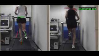 Video Gait Running Analysis Alignment Issues Rear View [upl. by Roos]