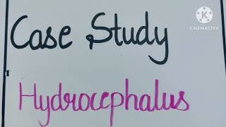 Case study on Hydrocephalus casestudy nursingcareplan pediatrics ncp [upl. by Joseph]