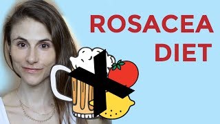 ROSACEA DIET FOODS SUPPLEMENTS PROBIOTICS DR DRAY [upl. by Teiluj]