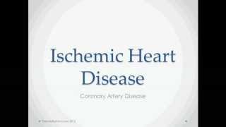 Ischemic Heart Disease  USMLE Step 2 Review [upl. by Oiralednac]