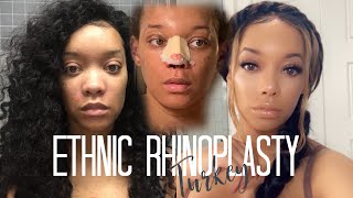 RHINOPLASTY QampA I GOT A NOSE JOB IN TURKEY and this happened  Peyton Charles [upl. by Dante881]