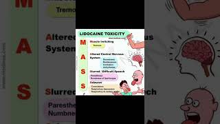 Meomonic for lidocaine toxicity shorts trendingshorts factsinhindi factshorts medicalfacts [upl. by Albertine]