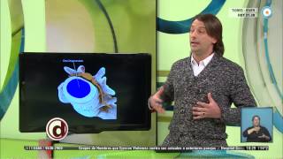 Red de salud  Hernia de disco  290715 [upl. by Neu996]