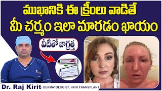 ఆ క్రీంలు వాడడం వల్ల  Skin Lite Cream Side Effects On Face  Steroid Cream  Celestee Clinic [upl. by Valaree]