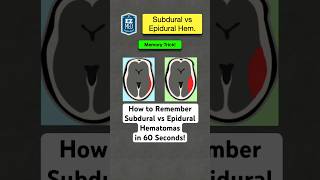 🔥 How to Remember Subdural vs Epidural Hematomas in 60 Seconds Nursing [upl. by Lenwood]