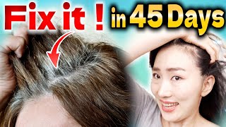 How to Stop Hair Loss and Regrow Hair Color Naturally with Scalp Lymphatic Drainage Massage [upl. by Sindee778]