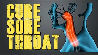 How To Get Rid Of Sore Throat Fast [upl. by Michiko540]