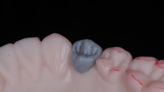 Encerado de primer premolar inferior en modelo MTJ [upl. by Carling494]