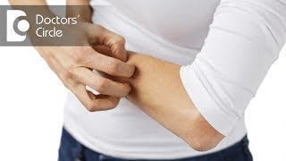 How to manage continuous itching over the body  Dr Rashmi Ravindra [upl. by Tihor496]