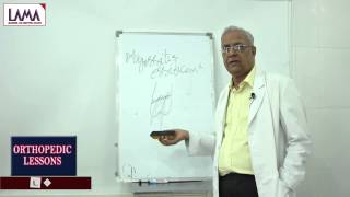 Supracondylar Fracture Complications and Management  Orthopedic Classes [upl. by Rebmetpes949]