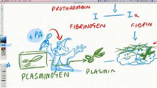 ICU Management  MATH Protocol Part 3 [upl. by Chrysler]